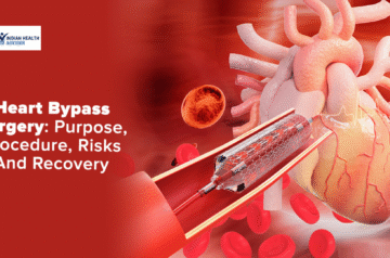 Discover the True Bypass Surgery Cost In India with Indian Health Adviser – Quality Healthcare Within Reach