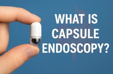 Understanding Capsule Endoscopy: A Non-Invasive Way to Detect GI Issues