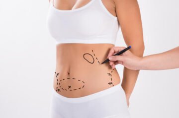 Best Liposuction Doctors in Dubai Reveal to Achieve Perfect Contours