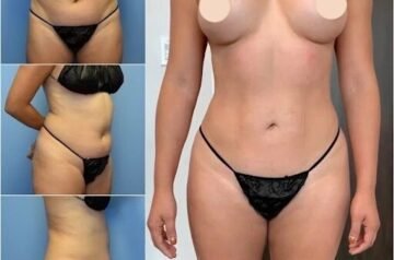 A Comprehensive Guide to the Best Doctors in Dubai for Body Contouring