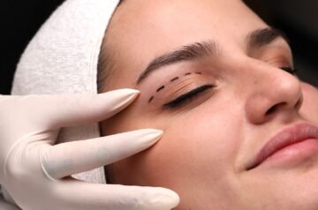 Eyelid Surgery in Islamabad – Rejuvenate Your Eyes Naturally