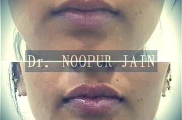 Healthy, Confident & Naturally Radiant Skin with Skin Zest