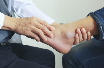 Ankle Surgeon in Jaipur: Expert Care, Treatment & Recovery Guide