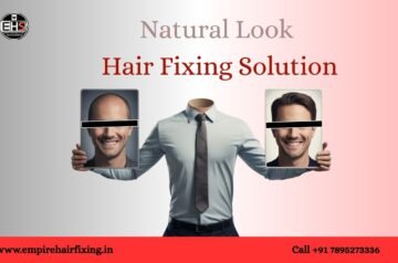 Top Benefits of Hair Replacement in 2026