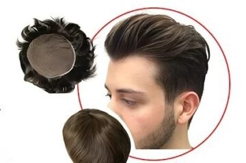 Non-Surgical Hair Replacement: Benefits & Results