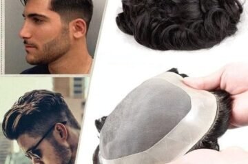 Hair Replacement Systems: How They Work