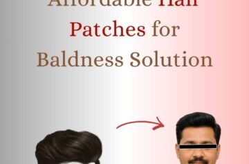 Styling Tips for Hair Patch Wearers: Look Natural and Confident