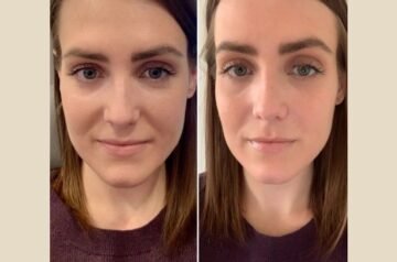 Best Plastic Surgeons in Dubai Leading PRP Treatment Innovation