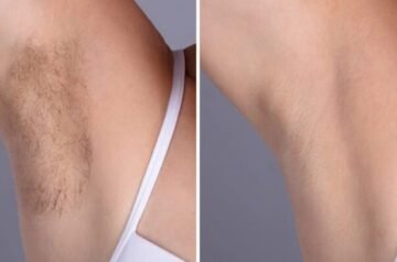 Best Aesthetic Clinic in dubai: for Fast Laser Hair Removal Sessions